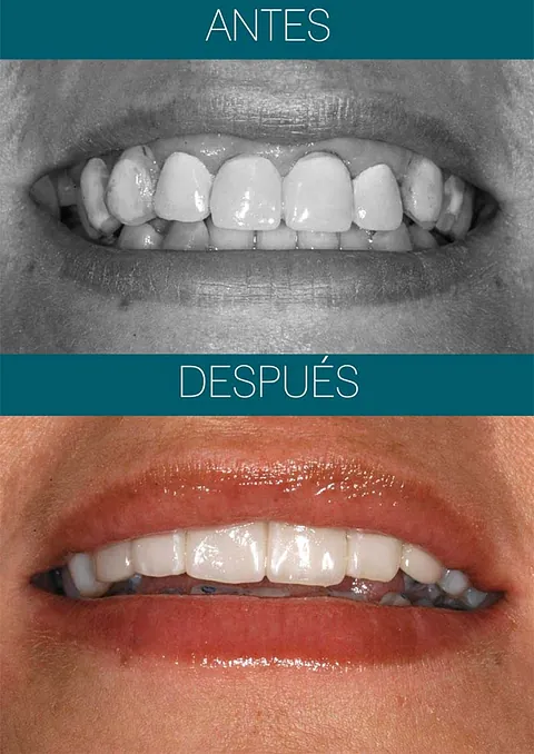 Clínica Dental Dr. Jacobo Álvarez Rehabilitación Oral