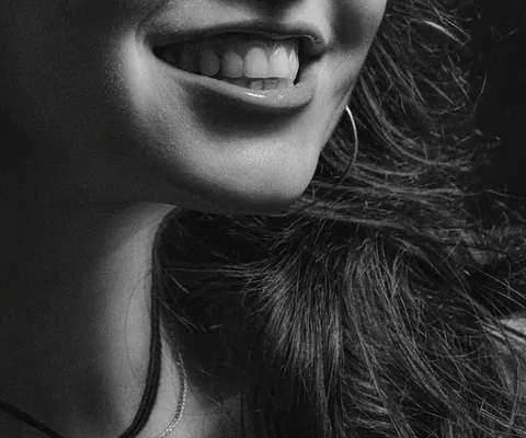 Clínica Dental Dr. Jacobo Álvarez estética dental 